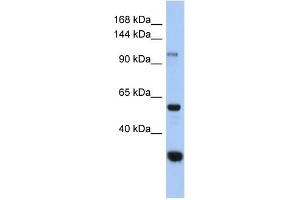 Image no. 1 for anti-Glucosidase, Alpha, Neutral C (GANC) (Middle Region) antibody (ABIN2786405)