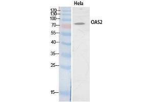 Image no. 1 for anti-2'-5'-Oligoadenylate Synthetase 2, 69/71kDa (OAS2) (Internal Region) antibody (ABIN3181072)
