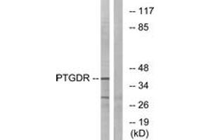 Image no. 1 for anti-Prostaglandin D2 Receptor (PTGDR) (AA 263-312) antibody (ABIN1536072)
