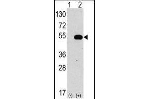 ATG4C Antikörper  (N-Term)