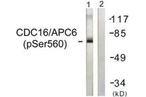 Western blot analysis of extracts from HuvEc cells, using CDC16/APC6 (Phospho-Ser560) Antibody.