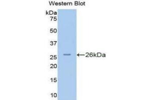 Image no. 1 for anti-Protein Kinase N2 (PKN2) (AA 282-487) antibody (ABIN1175312)