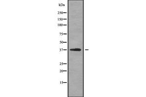 Image no. 1 for anti-Opticin (OPTC) (Internal Region) antibody (ABIN6263827)