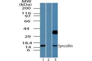 Image no. 1 for anti-Syncollin (SYCN) (AA 50-100) antibody (ABIN960366)