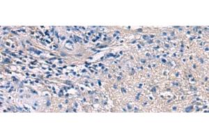 Immunohistochemistry of paraffin-embedded Human brain tissue using PROKR2 Polyclonal Antibody at dilution of 1:40(x200)