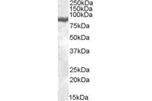 Image no. 2 for anti-Lactotransferrin (LTF) (Internal Region) antibody (ABIN308453)