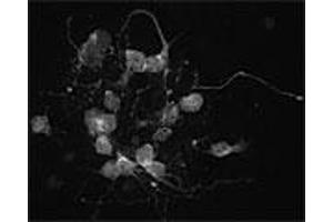Image no. 1 for anti-T-Cell Lymphoma Invasion and Metastasis 1 (TIAM1) antibody (ABIN351007)