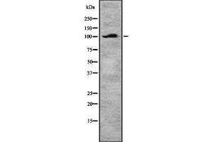 Image no. 1 for anti-Disabled Homolog 2, Mitogen-Responsive phosphoprotein (Drosophila) (DAB2) (C-Term) antibody (ABIN6261215)