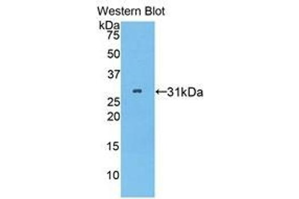 anti-Pitrilysin Metallopeptidase 1 (PITRM1) (AA 544-806) antibody