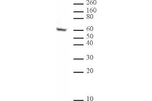 Image no. 1 for anti-IKAROS Family Zinc Finger 1 (Ikaros) (IKZF1) (N-Term) antibody (ABIN6972189)