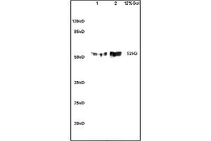 Image no. 3 for anti-Solute Carrier Family 2 (Facilitated Glucose Transporter) Member 8 (SLC2A8) (AA 401-477) antibody (ABIN705746)