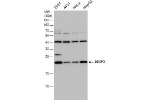 Image no. 1 for anti-Dual Specificity Phosphatase 3 (DUSP3) (full length) antibody (ABIN2856654)