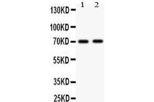 Image no. 4 for anti-Mitogen-Activated Protein Kinase Kinase Kinase 3 (MAP3K3) (AA 11-25), (N-Term) antibody (ABIN3044008)