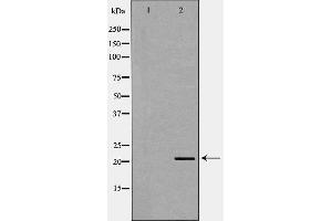 Image no. 1 for anti-Teratocarcinoma-Derived Growth Factor 1 (TDGF1) (Internal Region) antibody (ABIN6265513)