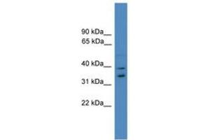 Image no. 1 for anti-Ubiquitin Fusion Degradation Protein 1 Homolog (UFD1L) (AA 161-210) antibody (ABIN6745307)