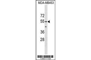 Image no. 1 for anti-Coronin, Actin Binding Protein, 1B (CORO1B) (AA 383-409), (C-Term) antibody (ABIN1537237)
