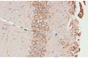 Immunohistochemistry of paraffin-embedded Mouse brain using CHRM1 Polyclonal Antibody at dilution of 1:100 (40x lens).