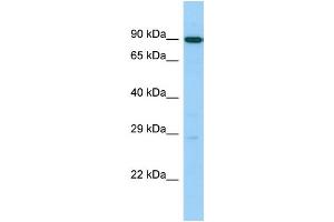 Image no. 1 for anti-UTP14, U3 Small Nucleolar Ribonucleoprotein, Homolog C (UTP14C) (C-Term) antibody (ABIN2790881)
