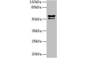 Keratin 72 Antikörper  (AA 301-511)