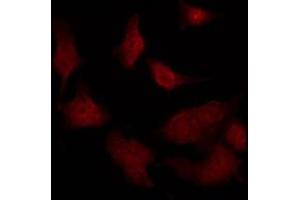anti-Regulator of G-Protein Signalling 12 (RGS12) (N-Term) antibody