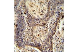 Image no. 1 for anti-Peroxisome Proliferator-Activated Receptor Gamma, Coactivator-Related 1 (PPRC1) (AA 1636-1664), (C-Term) antibody (ABIN954283)