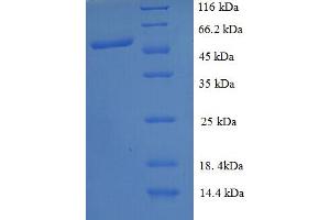 PICK1 Protein (AA 1-200, partial) (GST tag)