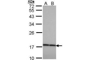 anti-Crystallin, beta A4 (CRYbA4) (AA 1-185), (N-Term) antibody