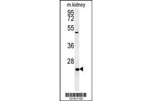 Image no. 1 for anti-Shisa Homolog 2 (SHISA2) (AA 259-288), (C-Term) antibody (ABIN652141)