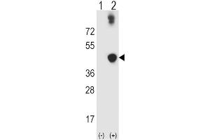 Image no. 3 for anti-Alcohol Dehydrogenase 5 (Class III), chi Polypeptide (ADH5) antibody (ABIN3003804)