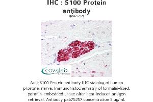 anti-S100 Protein (S100) antibody