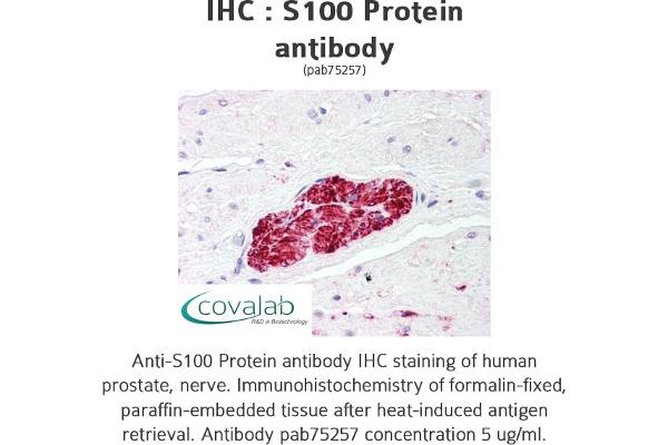 anti-S100 Protein (S100) antibody
