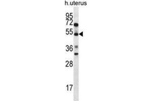 Image no. 2 for anti-Actin-Binding rho Activating Protein (ABRA) (AA 282-312), (C-Term) antibody (ABIN950219)