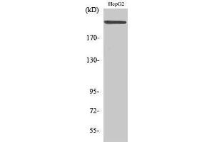 Image no. 1 for anti-Microtubule Associated serine/threonine Kinase 2 (MAST2) (Internal Region) antibody (ABIN3185471)