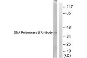 Image no. 1 for anti-Polymerase (DNA Directed), beta (POLB) (AA 286-335) antibody (ABIN1533255)