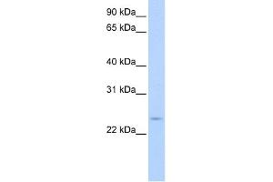 WB Suggested Anti-CIP29 Antibody Titration:  0.