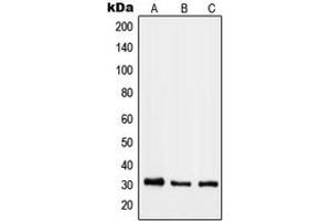 Image no. 1 for anti-RAB40B, Member RAS Oncogene Family (RAB40B) (C-Term) antibody (ABIN2705166)