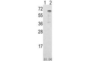 Image no. 2 for anti-Calcium/calmodulin-Dependent Protein Kinase Kinase 1, alpha (CAMKK1) (AA 337-369) antibody (ABIN3028524)