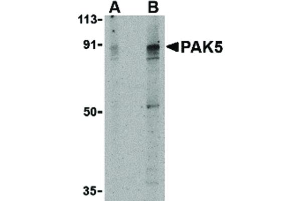anti-P21 Protein (Cdc42/Rac)-Activated Kinase 7 (PAK7) (Internal Region) antibody