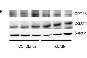 Image no. 4 for anti-Carnitine Palmitoyltransferase 1A (Liver) (CPT1A) antibody (ABIN6138976)