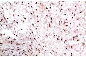 Immunohistochemistry of paraffin-embedded Human colon carcinoma tissue using CBX3 Monoclonal Antibody at dilution of 1:200.