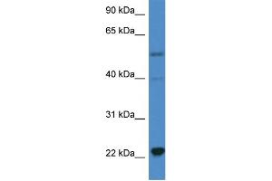 Image no. 2 for anti-Interleukin 18 (IL18) (C-Term) antibody (ABIN2788556)