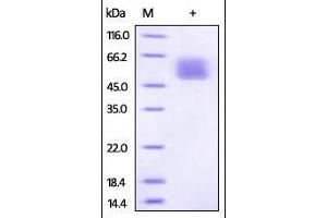Image no. 1 for Interleukin 13 Receptor, alpha 1 (IL13RA1) (AA 26-340) protein (His tag) (ABIN2181339)