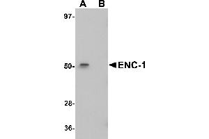 Western Blotting (WB) image for anti-Ectodermal-Neural Cortex 1 (With BTB-Like Domain) (ENC1) (Middle Region) antibody (ABIN1030924)
