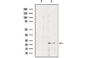 Image no. 2 for anti-RAB1B, Member RAS Oncogene Family (RAB1B) antibody (ABIN6264562)