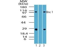 Image no. 1 for anti-Basonuclin 1 (BNC1) (AA 330-380) antibody (ABIN960100)