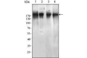 EGFR antibody  (Mutant)
