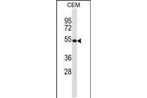 Image no. 1 for anti-Netrin 3 (Ntn3) (AA 431-459), (C-Term) antibody (ABIN5533350)