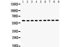 Image no. 4 for anti-Heat Shock 60kDa Protein 1 (Chaperonin) (HSPD1) (AA 260-496) antibody (ABIN3043854)