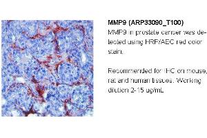 Image no. 2 for anti-Matrix Metallopeptidase 9 (Gelatinase B, 92kDa Gelatinase, 92kDa Type IV Collagenase) (MMP9) (N-Term) antibody (ABIN2777743)