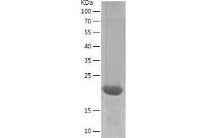 PTGDS Protein (AA 23-190) (His tag)
